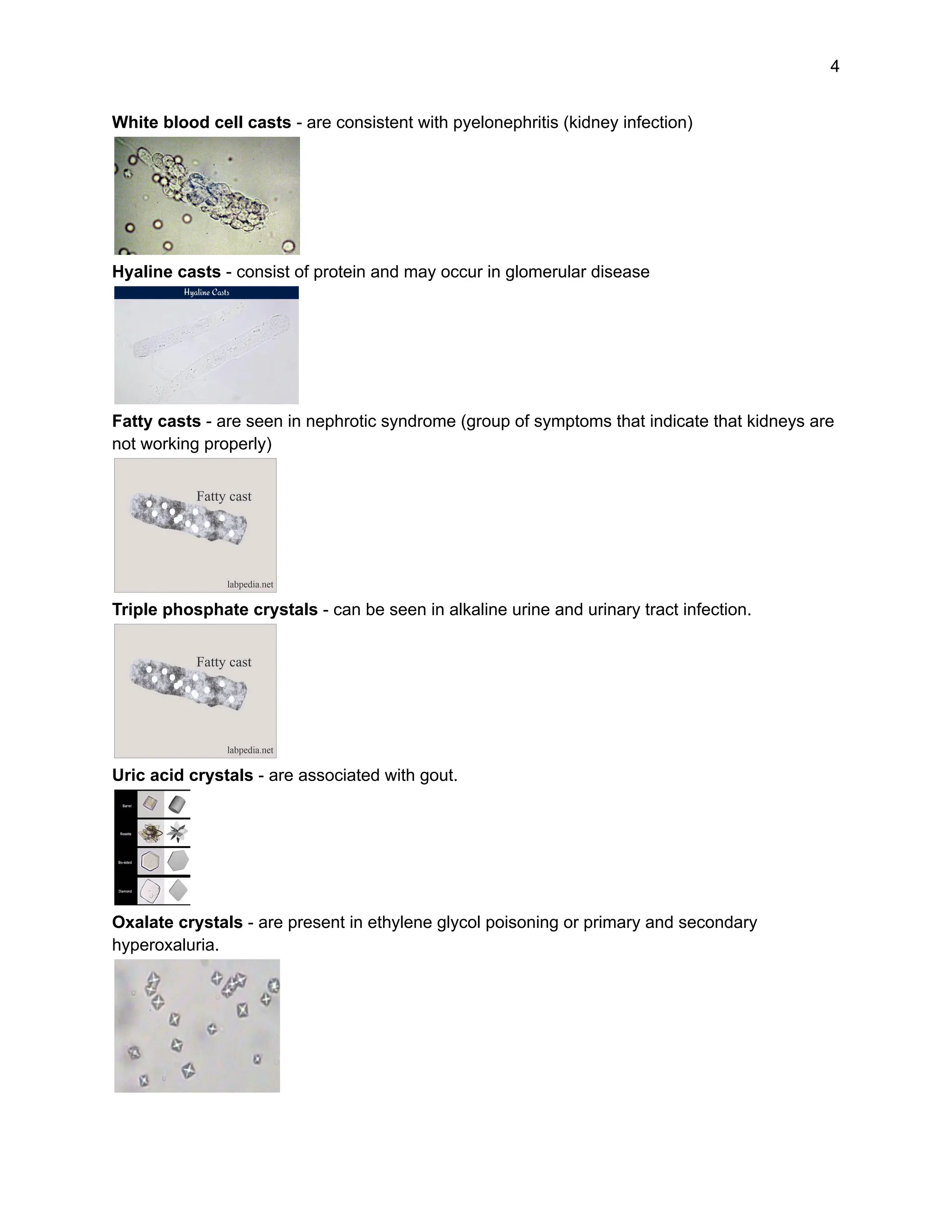 4
White blood cell casts - are consistent with pyelonephritis (kidney infection)
Hyaline casts - consist of protein and may occur in glomerular disease
Fatty casts - are seen in nephrotic syndrome (group of symptoms that indicate that kidneys are
not working properly)
Triple phosphate crystals - can be seen in alkaline urine and urinary tract infection.
Uric acid crystals - are associated with gout.
Oxalate crystals - are present in ethylene glycol poisoning or primary and secondary
hyperoxaluria.
 