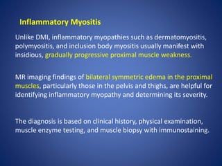 Inflammatory Myositis
Unlike DMI, inflammatory myopathies such as dermatomyositis,
polymyositis, and inclusion body myositis usually manifest with
insidious, gradually progressive proximal muscle weakness.
MR imaging findings of bilateral symmetric edema in the proximal
muscles, particularly those in the pelvis and thighs, are helpful for
identifying inflammatory myopathy and determining its severity.
The diagnosis is based on clinical history, physical examination,
muscle enzyme testing, and muscle biopsy with immunostaining.
 