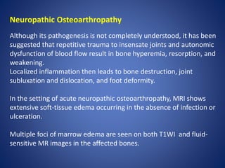 Neuropathic Osteoarthropathy
Although its pathogenesis is not completely understood, it has been
suggested that repetitive trauma to insensate joints and autonomic
dysfunction of blood flow result in bone hyperemia, resorption, and
weakening.
Localized inflammation then leads to bone destruction, joint
subluxation and dislocation, and foot deformity.
In the setting of acute neuropathic osteoarthropathy, MRI shows
extensive soft-tissue edema occurring in the absence of infection or
ulceration.
Multiple foci of marrow edema are seen on both T1WI and fluid-
sensitive MR images in the affected bones.
 