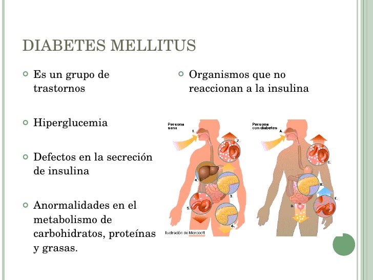 Dm nutricion Dm nutricion