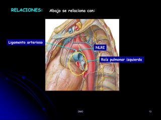 DMO 13
RELACIONES: Abajo se relaciona con:
Raíz pulmonar izquierda
Ligamento arterioso
NLRI
Comunica la aorta
com la A.P.I
 
