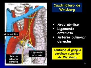 Cuadrilátero de
Wrisberg
 Arco aórtico
 Ligamento
arterioso
 Arteria pulmonar
derecha
Contiene al ganglio
cardíaco superior
de Wrisberg
Arteria
pulmonar
derecha
Ligamento
arterioso
Arco aórtico
DMO 14
 