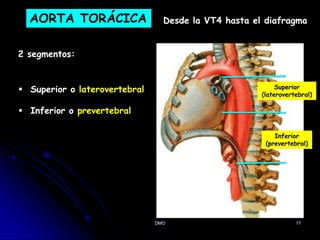 DMO 17
AORTA TORÁCICA
2 segmentos:
Desde la VT4 hasta el diafragma
 Superior o laterovertebral
 Inferior o prevertebral
Superior
(laterovertebral)
Inferior
(prevertebral)
 
