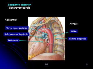 18
Segmento superior
(laterovertebral)
Adelante:
Raíz pulmonar izquierda
Pericardio
Nervio vago izquierdo
Atrás:
Cadena simpática
VHAA
DMO
 