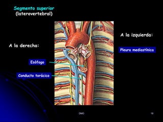 DMO 19
Segmento superior
(laterovertebral)
A la derecha:
A la izquierda:
Esófago
Conducto torácico
Pleura mediastínica
 
