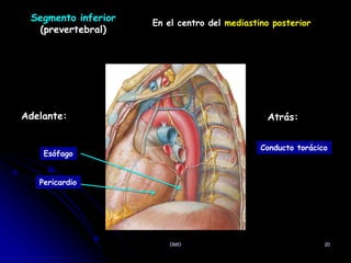 DMO 20
Segmento inferior
(prevertebral)
En el centro del mediastino posterior
Adelante:
Pericardio
Esófago
Atrás:
Conducto torácico
 