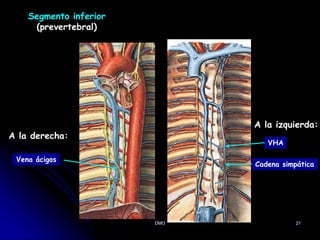 DMO 21
Segmento inferior
(prevertebral)
A la derecha:
VHA
Vena ácigos
A la izquierda:
Cadena simpática
 