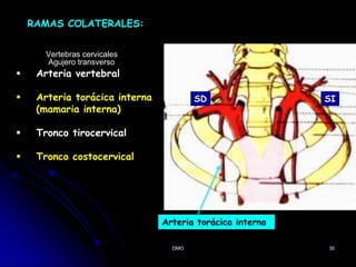 DMO 30
RAMAS COLATERALES:
 Arteria vertebral
 Arteria torácica interna
(mamaria interna)
 Tronco tirocervical
 Tronco costocervical
Arteria torácica interna
SI
SD
Vertebras cervicales
Agujero transverso
 