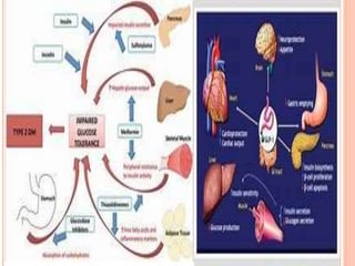 Dm pediatric | PPTX