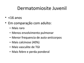 Dermatomiosite Juvenil
• <16 anos
• Em comparação com adulto:
– Mais raro
– Menos envolvimento pulmonar
– Menor frequencia de auto-anticorpos
– Mais calcinose (40%)
– Mais vasculite de TGI
– Mais febre e perda ponderal
 
