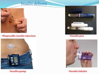 •Disposable insulin injection
•Insulin pump
•Insulin pen
•Insulin Inhaler
Insulin delivery
 