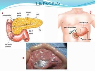 THE PANCREAS
1
2
3
 