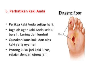 6. Perhatikan kaki Anda
• Periksa kaki Anda setiap hari.
• Jagalah agar kaki Anda selalu
bersih, kering dan lembut
• Gunakan kaus kaki dan alas
kaki yang nyaman
• Potong kuku jari kaki lurus,
sejajar dengan ujung jari
 