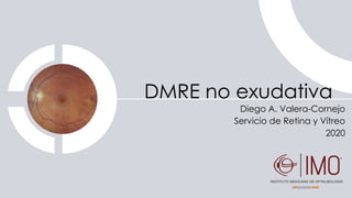 DMRE no exudativa
Diego A. Valera-Cornejo
Servicio de Retina y Vítreo
2020
 