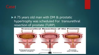 Turp Risk Stratification TURP case presentation.pptx