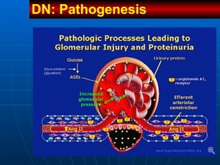 DN: Pathogenesis  