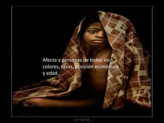 Afecta a personas de todos los colores, razas, posición económica y edad.