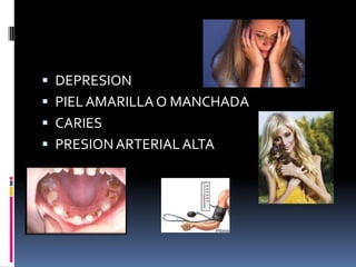 DEPRESION PIEL AMARILLA O MANCHADACARIESPRESION ARTERIAL ALTA