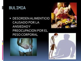 BULIMIADESORDEN ALIMENTICIO CAUSADO POR LA ANSIEDAD Y PREOCUPACION POR EL PESO CORPORAL