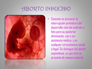 ABORTO INDUCIDO
        • Consiste en provocar la
          interrupción prematura del
          desarrollo vital del embrión o
          feto para su posterior
          eliminación, con o sin
          asistencia médica, y en
          cualquier circunstancia social
          o legal. Se distingue del aborto
          espontáneo, ya que éste se
          presenta de manera natural.
 