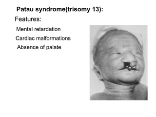 The difference between DNA and RNA: It contains the sugar ribose instead of deoxyribose. It contains the base uracil (U) instead of thymine (T) 