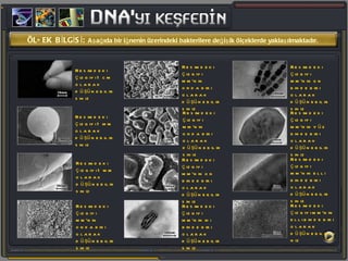 ÖLÇEK BİLGİSİ:  Aşağıda bir iğnenin üzerindeki bakterilere değişik ölçeklerde yaklaşılmaktadır. Resimdeki çizgiyi 1 cm olarak düşünebilirsiniz Resimdeki çizgiyi 1 mm olarak düşünebilirsiniz Resimdeki çizgiyi 1 mm olarak düşünebilirsiniz Resimdeki çizgiyi mm’nin onda biri olarak düşünebilirsiniz Resimdeki çizgiyi mm’nin onda biri olarak düşünebilirsiniz Resimdeki çizgiyi mm’nin onda biri olarak düşünebilirsiniz Resimdeki çizgiyi mm’nin on binde biri olarak düşünebilirsiniz Resimdeki çizgiyi mm’nin iki binde biri olarak düşünebilirsiniz Resimdeki çizgiyi mm’nin on binde biri olarak düşünebilirsiniz Resimdeki çizgiyi mm’nin yüz binde biri olarak düşünebilirsiniz Resimdeki çizgiyi mm’nin elli binde biri olarak düşünebilirsiniz Resimdeki çizgiyi mm’nin elli binde biri olarak düşünebilirsiniz 