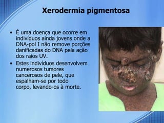 Xerodermia pigmentosa

• É uma doença que ocorre em
  indivíduos ainda jovens onde a
  DNA-pol I não remove porções
  danificadas do DNA pela ação
  dos raios UV.
• Estes indivíduos desenvolvem
  numerosos tumores
  cancerosos de pele, que
  espalham-se por todo
  corpo, levando-os à morte.
 