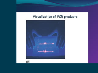 Visualization of PCR products

 