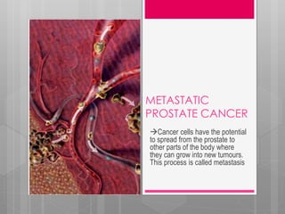 METASTATIC
PROSTATE CANCER
Cancer cells have the potential
to spread from the prostate to
other parts of the body where
they can grow into new tumours.
This process is called metastasis
 