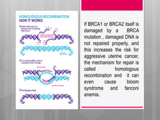 If BRCA1 or BRCA2 itself is
damaged by a BRCA
mutation , damaged DNA is
not repaired properly, and
this increases the risk for
aggressive uterine cancer,
the mechanism for repair is
called homologous
recombination and it can
even cause bloom
syndrome and fanconi
anemia.
 