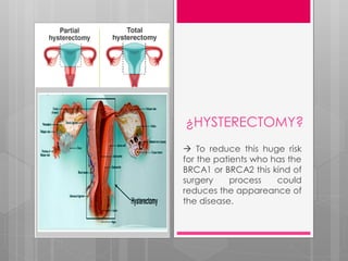 ¿HYSTERECTOMY?
 To reduce this huge risk
for the patients who has the
BRCA1 or BRCA2 this kind of
surgery process could
reduces the appareance of
the disease.
 
