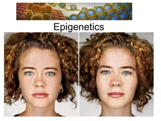 Epigenetics
 