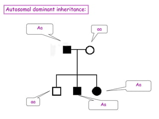 Autosomal dominant inheritance:
Aa aa
Aa
Aa
aa
 