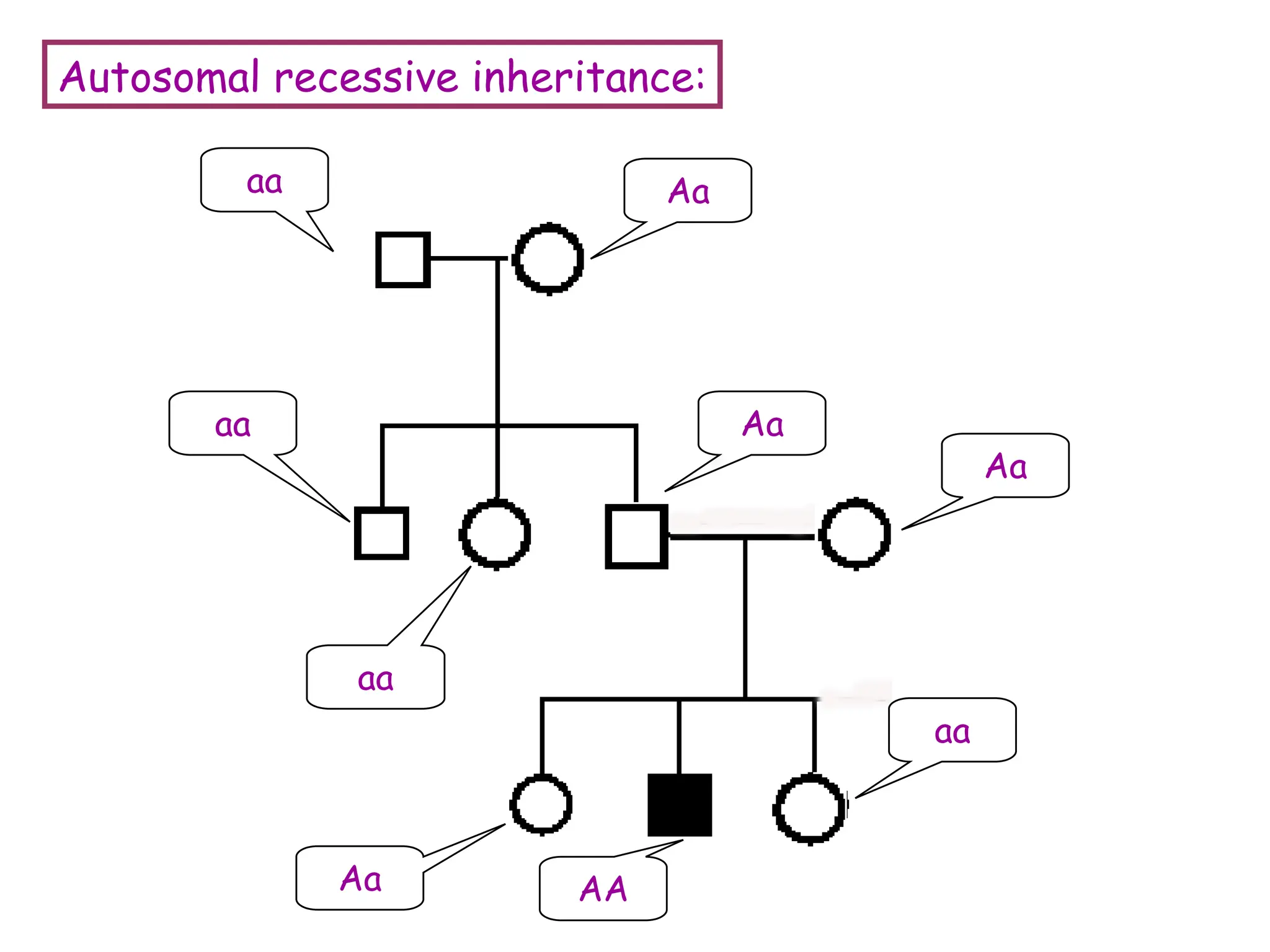 Autosomal recessive inheritance:
aa
aa
aa
Aa
Aa
Aa
AA
aa
Aa
 