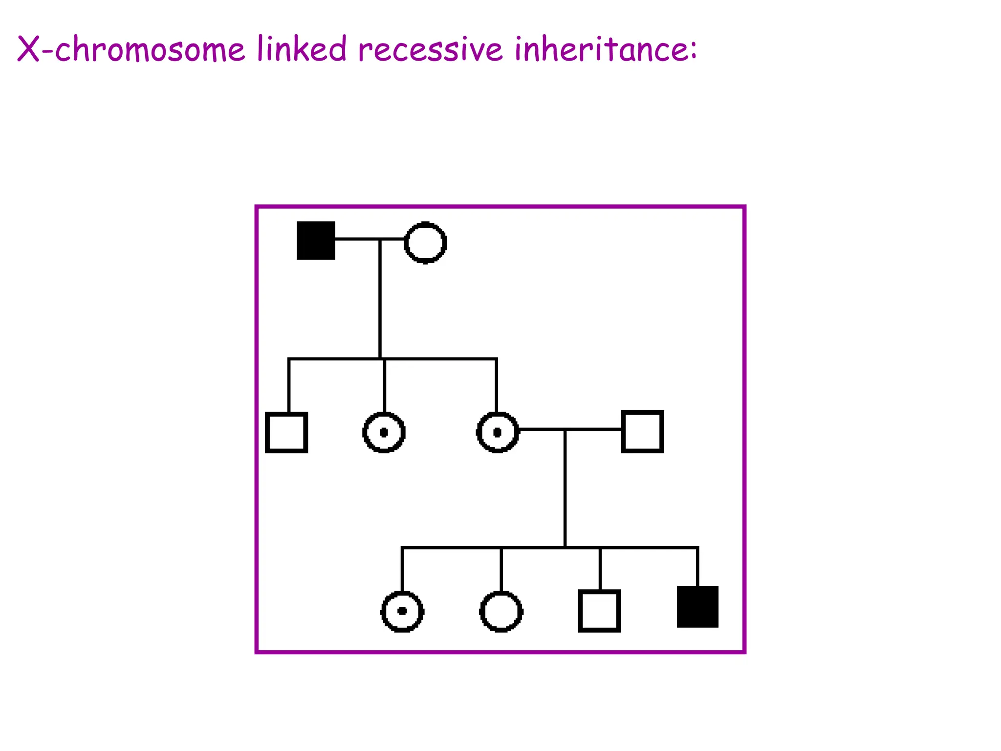X-chromosome linked recessive inheritance:
 