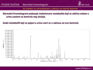 STUDIJE SLUČAJA     Normalan hromatogram                                        DNA PLUS
                    Svi markeri s...