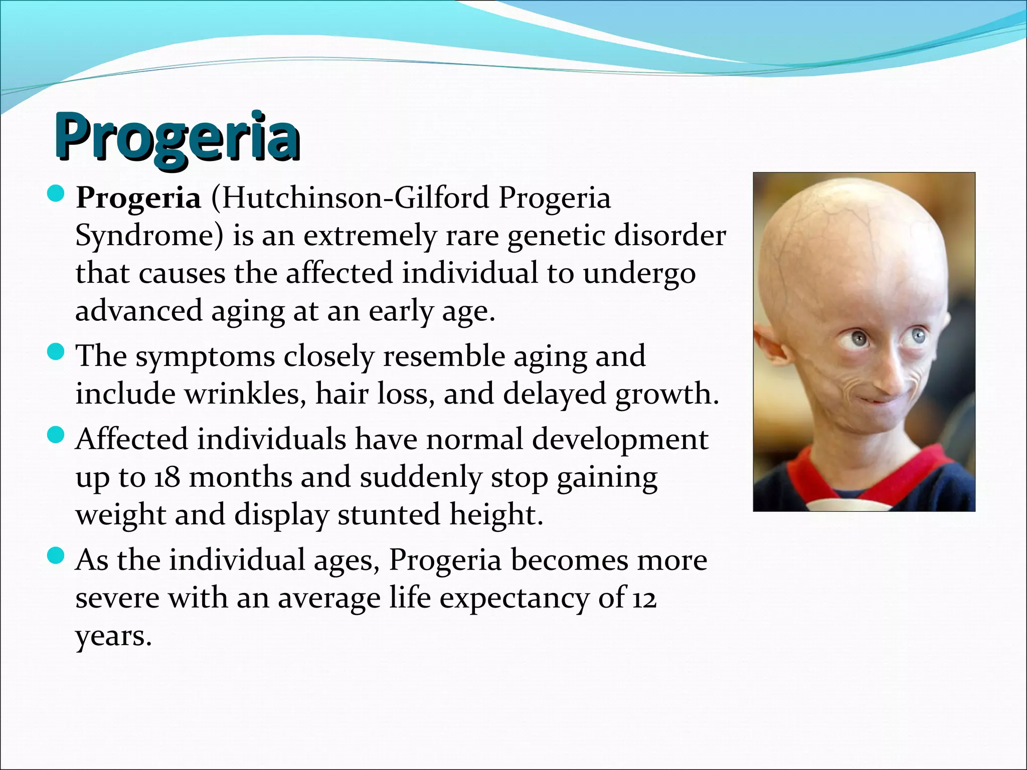 ProgeriaProgeria
Progeria (Hutchinson-Gilford Progeria
Syndrome) is an extremely rare genetic disorder
that causes the affected individual to undergo
advanced aging at an early age.
The symptoms closely resemble aging and
include wrinkles, hair loss, and delayed growth.
Affected individuals have normal development
up to 18 months and suddenly stop gaining
weight and display stunted height.
As the individual ages, Progeria becomes more
severe with an average life expectancy of 12
years.
 