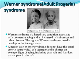 Werner syndrome(Adult Progeria)Werner syndrome(Adult Progeria)
syndromesyndrome
Werner syndrome is a hereditary condition associated
with premature aging and an increased risk of cancer and
other diseases. The signs of Werner syndrome usually
develop in the teenage years.
A person with Werner syndrome does not have the usual
growth spurt typical of a teenager and is shorter on
average. Signs of aging, including gray hair and hair loss,
may appear in the 20's.
 