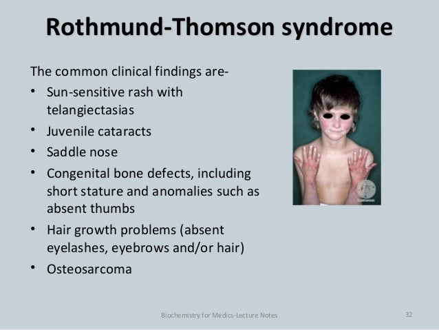 Rothmund-Thomson syndrome | DermNet New Zealand