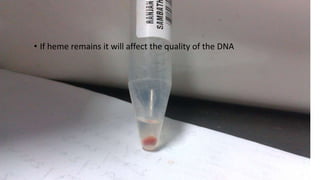 • If heme remains it will affect the quality of the DNA
 