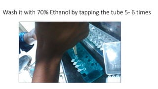 Wash it with 70% Ethanol by tapping the tube 5- 6 times
 