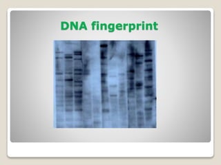 DNA fingerprint
 
