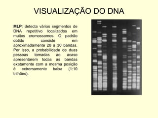 VISUALIZAÇÃO DO DNA
MLP: detecta vários segmentos de
DNA repetitivo localizados em
muitos cromossomos. O padrão
obtido consiste em
aproximadamente 20 a 30 bandas.
Por isso, a probabilidade de duas
pessoas tomadas ao acaso
apresentarem todas as bandas
exatamente com a mesma posição
é extremamente baixa (1:10
trilhões).
 