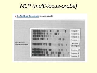 MLP (multi-locus-probe)
 