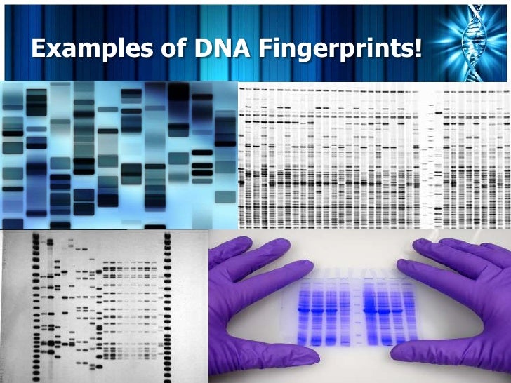 Dna fingerprinting!