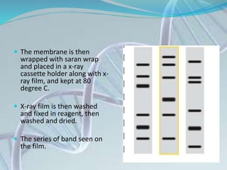 The membrane is then
wrapped with saran wrap
and placed in a x-ray
cassette holder along with x-
ray film, and kept at 80
degree C.
 X-ray film is then washed
and fixed in reagent, then
washed and dried.
 The series of band seen on
the film.
 