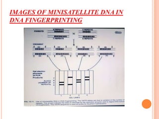 IMAGES OF MINISATELLITE DNA IN
DNA FINGERPRINTING
 