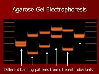 Agarose Gel Electrophoresis
Different banding patterns from different individuals
 