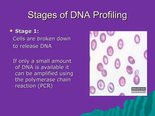 Stages of DNA Profiling
 Stage 1:
 Cells are broken down
 to release DNA

 If only a small amount
  of DNA is available it
  can be amplified using
  the polymerase chain
  reaction (PCR)
 
