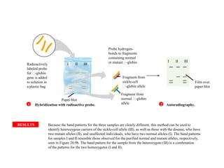 RESULTS Because the band patterns for the three samples are clearly different, this method can be used to
identify heterozygous carriers of the sickle-cell allele (III), as well as those with the disease, who have
two mutant alleles (II), and unaffected individuals, who have two normal alleles (I). The band patterns
for samples I and II resemble those observed for the purified normal and mutant alleles, respectively,
seen in Figure 20.9b. The band pattern for the sample from the heterozygote (III) is a combination
of the patterns for the two homozygotes (I and II).
Radioactively
labeled probe
for -globin
gene is added
to solution in
a plastic bag
Probe hydrogen-
bonds to fragments
containing normal
or mutant -globin
Fragment from
sickle-cell
-globin allele
Fragment from
normal -globin
allele
Paper blot
Film over
paper blot
Hybridization with radioactive probe. Autoradiography.
I II III
I II III
1 2
 